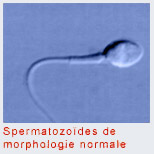 Spermatozoïdes de morphologie normale