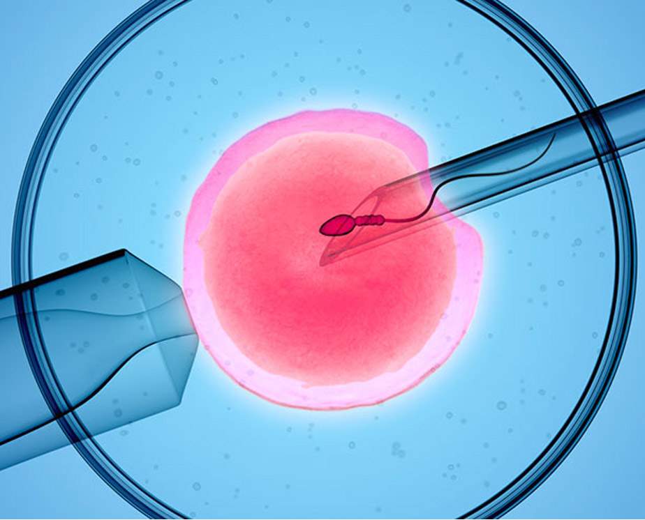 Fécondation in vitro